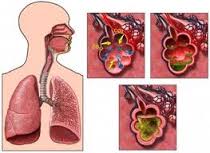 obat herbal penyakit paru paru